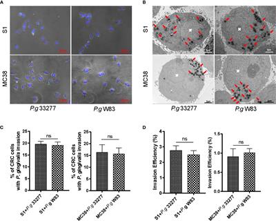 Intracellular Porphyromonas gingivalis Promotes the Proliferation of Colorectal Cancer Cells via the MAPK/ERK Signaling Pathway